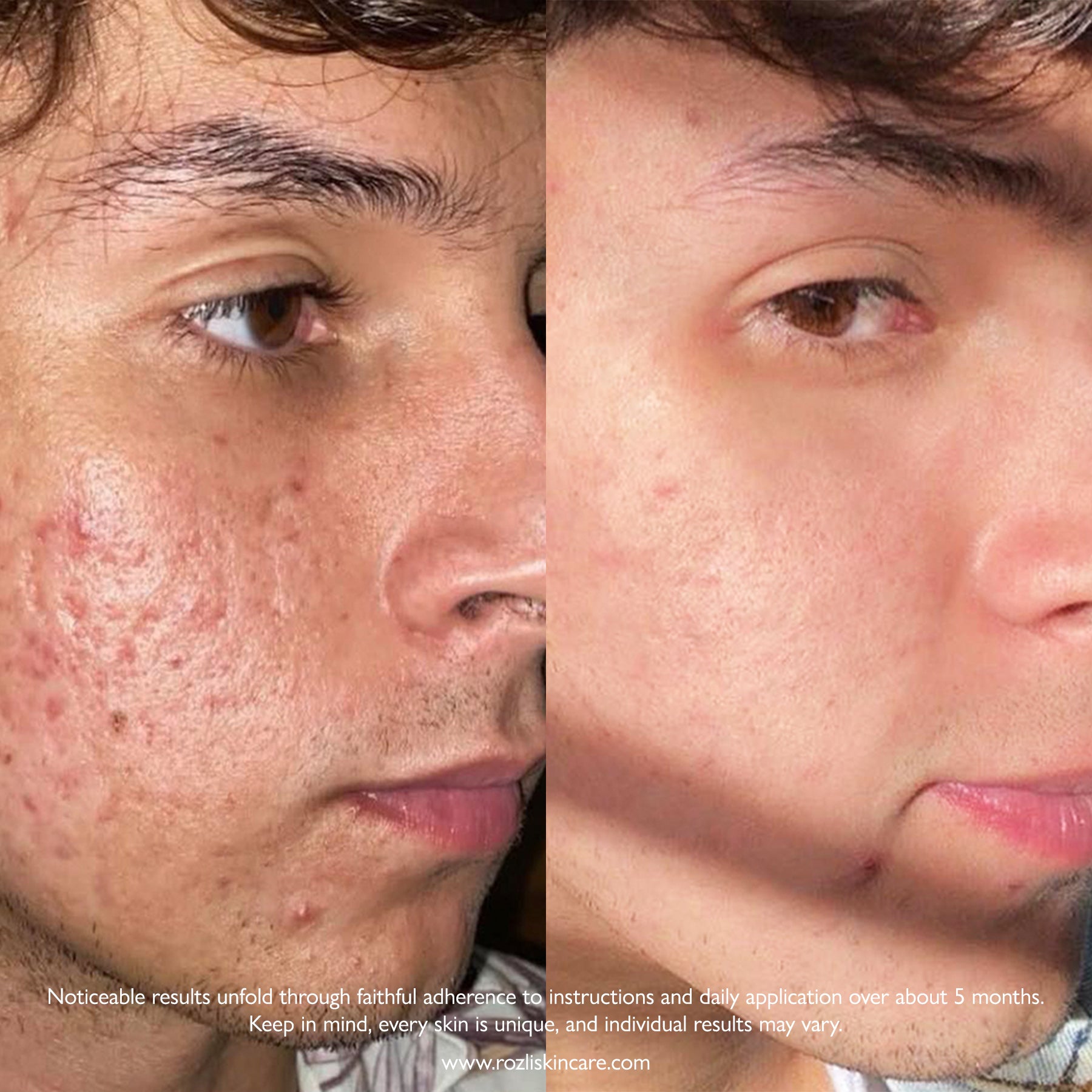 ROZLI Skincare | Revitalizing Nighttime Face Cream